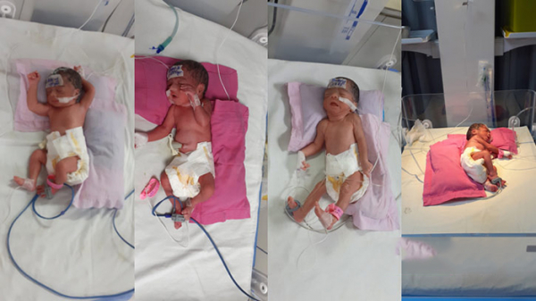 নোয়াখালীতে একসঙ্গে চার নবজাতক জন্ম দিলেন মা