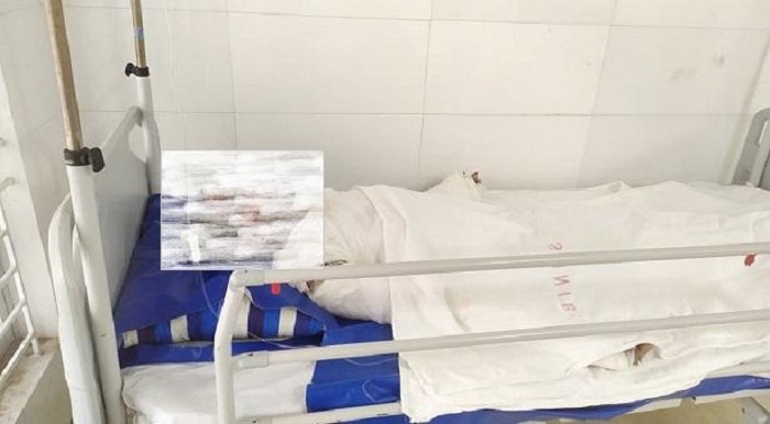 রাজধানীতে গ্যাস লাইন বিস্ফোরণে শিশু নিহত, দগ্ধ ৩