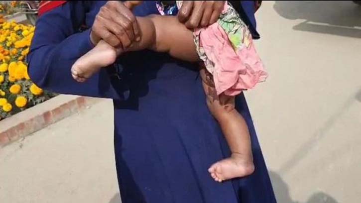 সাত মাসের শিশুকে এসিড নিক্ষেপ, নারী আটক