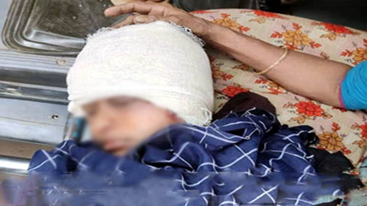 বানিয়াচংয়ে ঘরে ঢুকে কিশোরীকে কুপিয়ে জখম