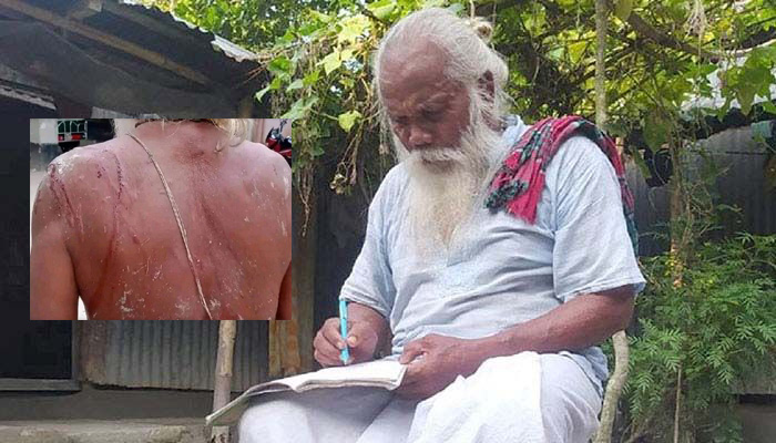 নাগেশ্বরীতে চারণ কবি রাধাপদ রায়ের ওপর হামলা