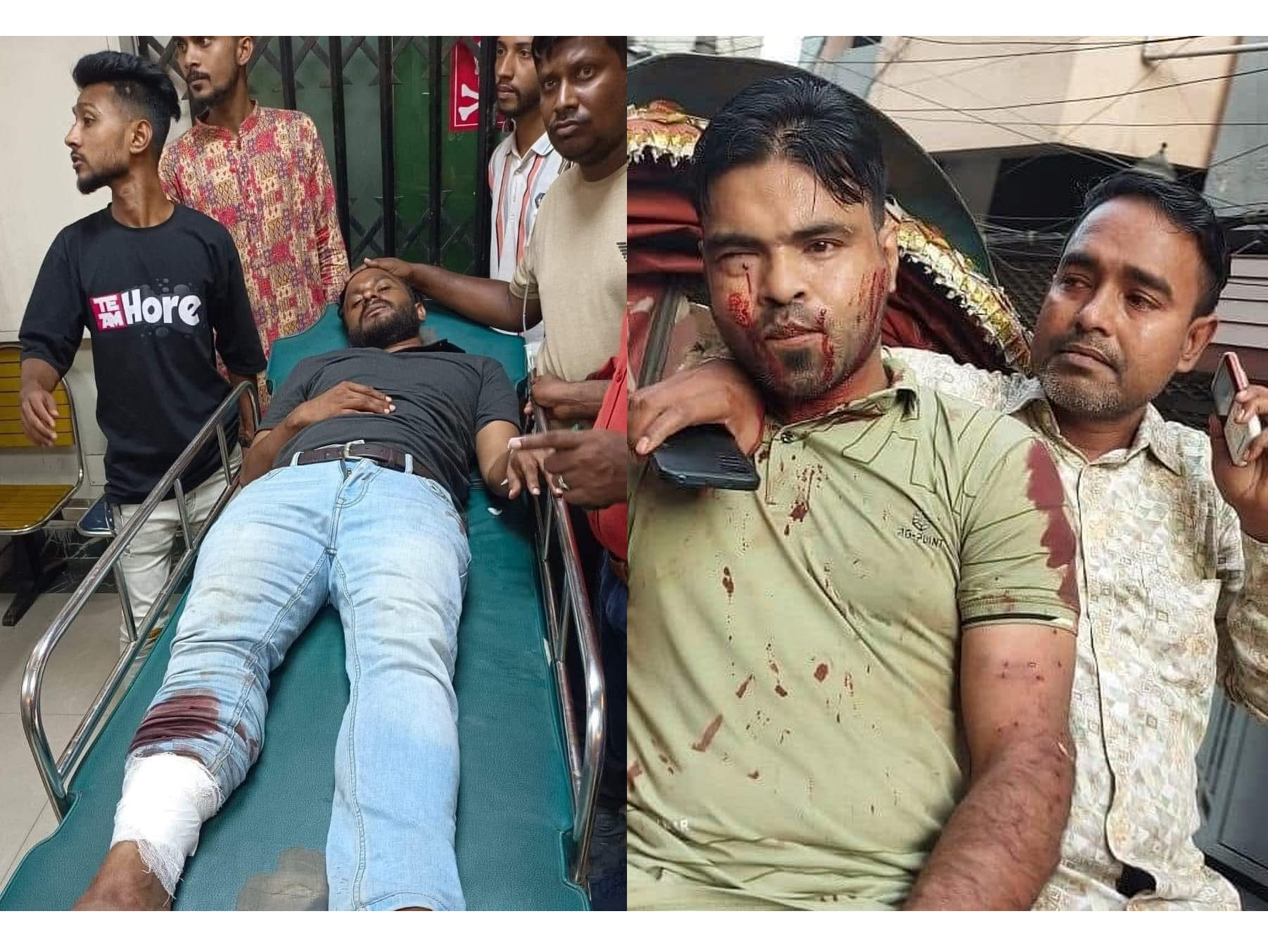 মৌলভীবাজার সরকারি কলেজে ছাত্রদলের সভায় ছাত্রলীগের হামলা: অন্তত ১৫ জন আহত, ৫ জন গুরুতর অবস্থায় হাসপাতালে ভর্তি